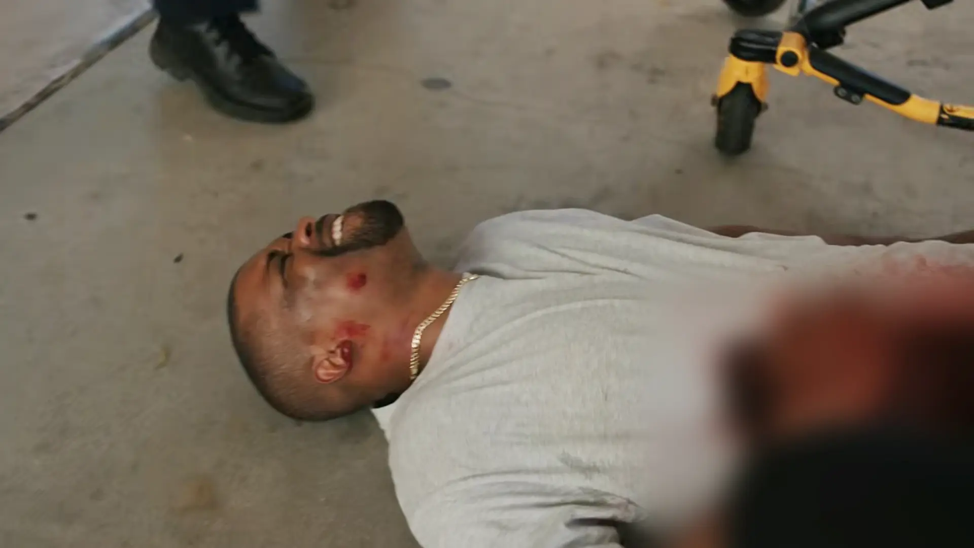 Patient se présentant à l'aire des ambulances avec une plaie abdominale par arme à feu (PAF).