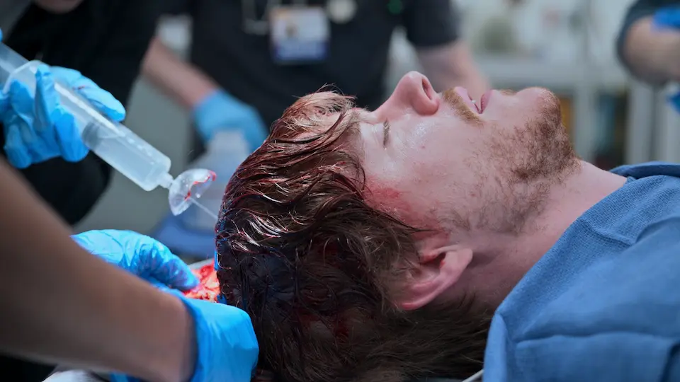 Dante arrivant au service des urgences avec une vaste plaie du cuir chevelu, siège d'un saignement actif.