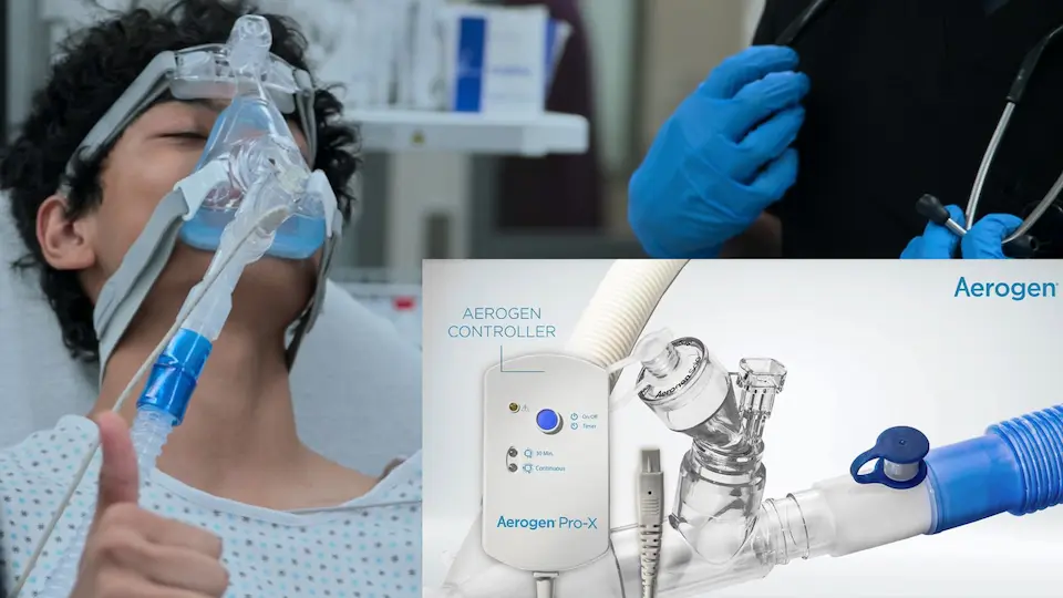 Patient recevant des bronchodilatateurs nébulisés via un nébuliseur à tamis vibrant Aerogen intégré en ligne au circuit de VNI.