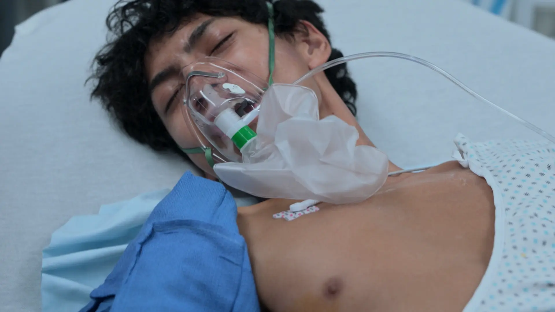 Patient montrant un soulagement respiratoire immédiat et une inspiration spontanée suite à la décompression réussie d'un pneumothorax suffocant droit.