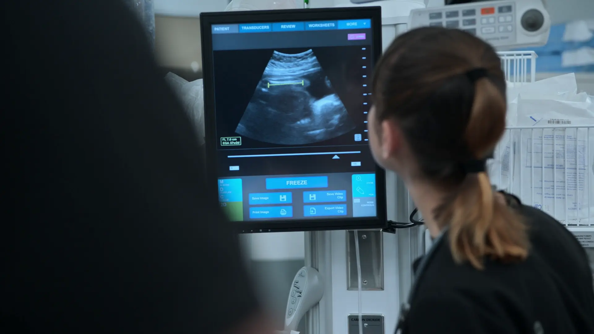 Échographie obstétricale au lit mesurant la longueur fémorale fœtale pour estimer l'âge gestationnel.