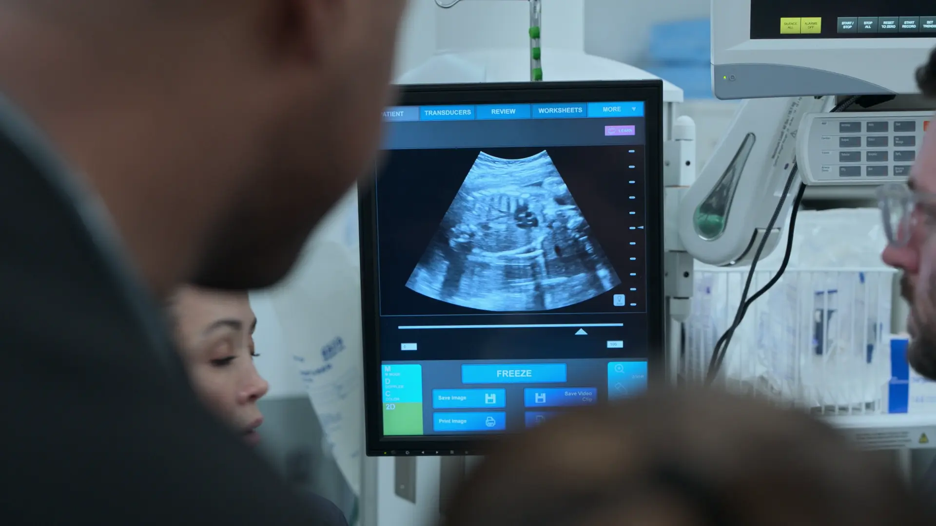 Échographie au lit visualisant la chute du rythme cardiaque fœtal à 90 bpm pendant la crise maternelle.