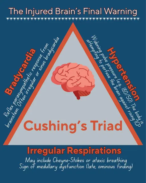 Infografik zur Cushing-Trias: Hypertonie, Bradykardie und unregelmäßige Atmung.