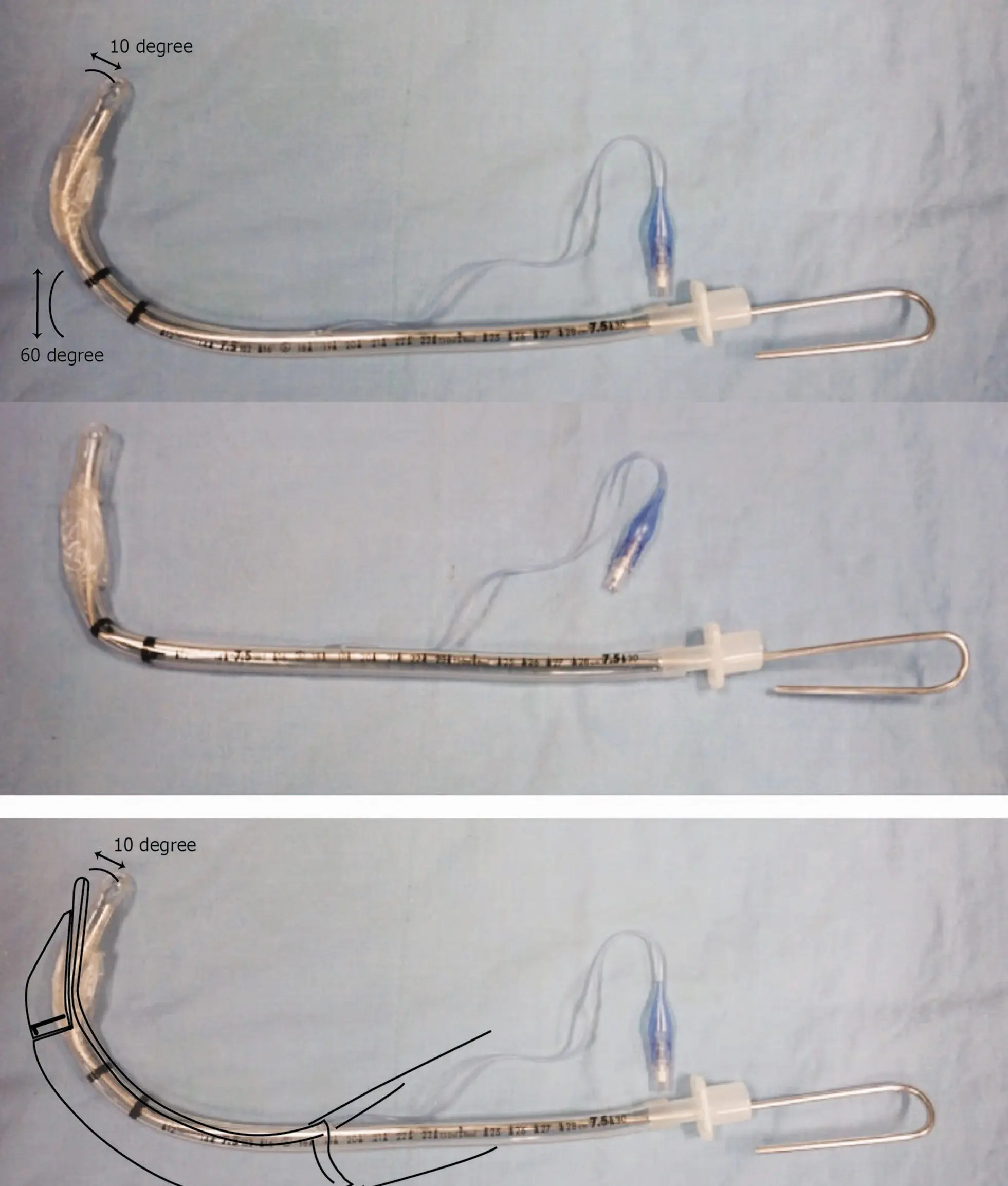 Endotracheal tube with a stylet bent into a 'hockey stick' shape, accompanied by an anatomical overlay.